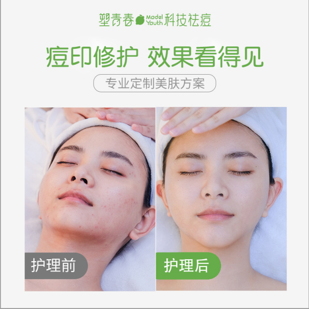 上火导致脸上长痘痘怎么调理